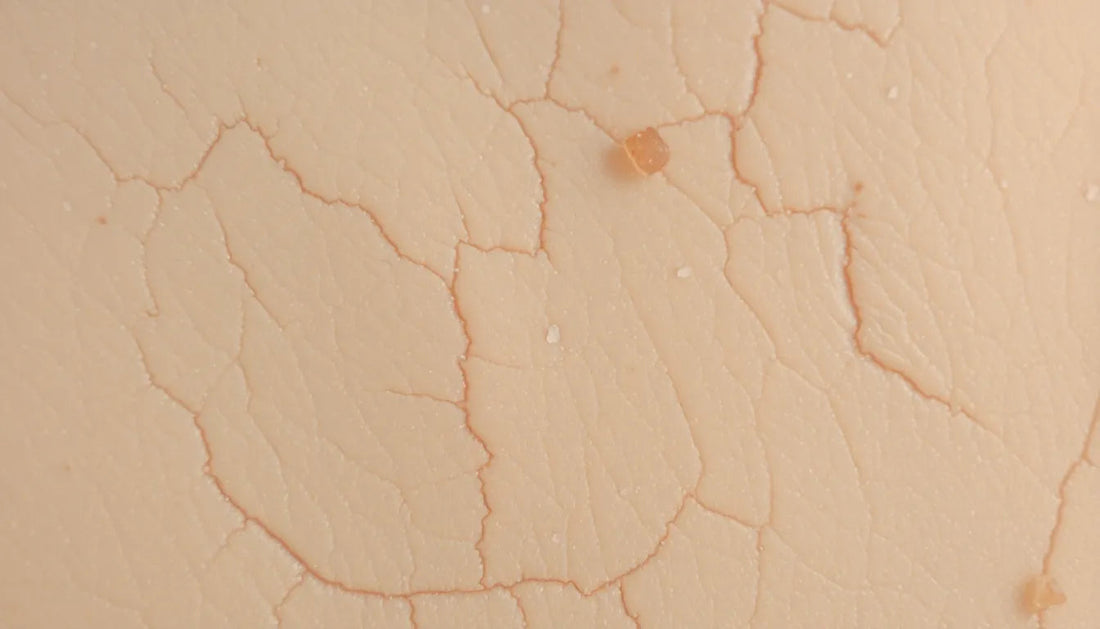 The Top 5 Best Ingredients for Dry Skin