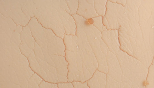 The Top 5 Best Ingredients for Dry Skin