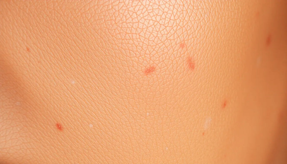 5 Powerful Ingredients for Skin Pigmentation