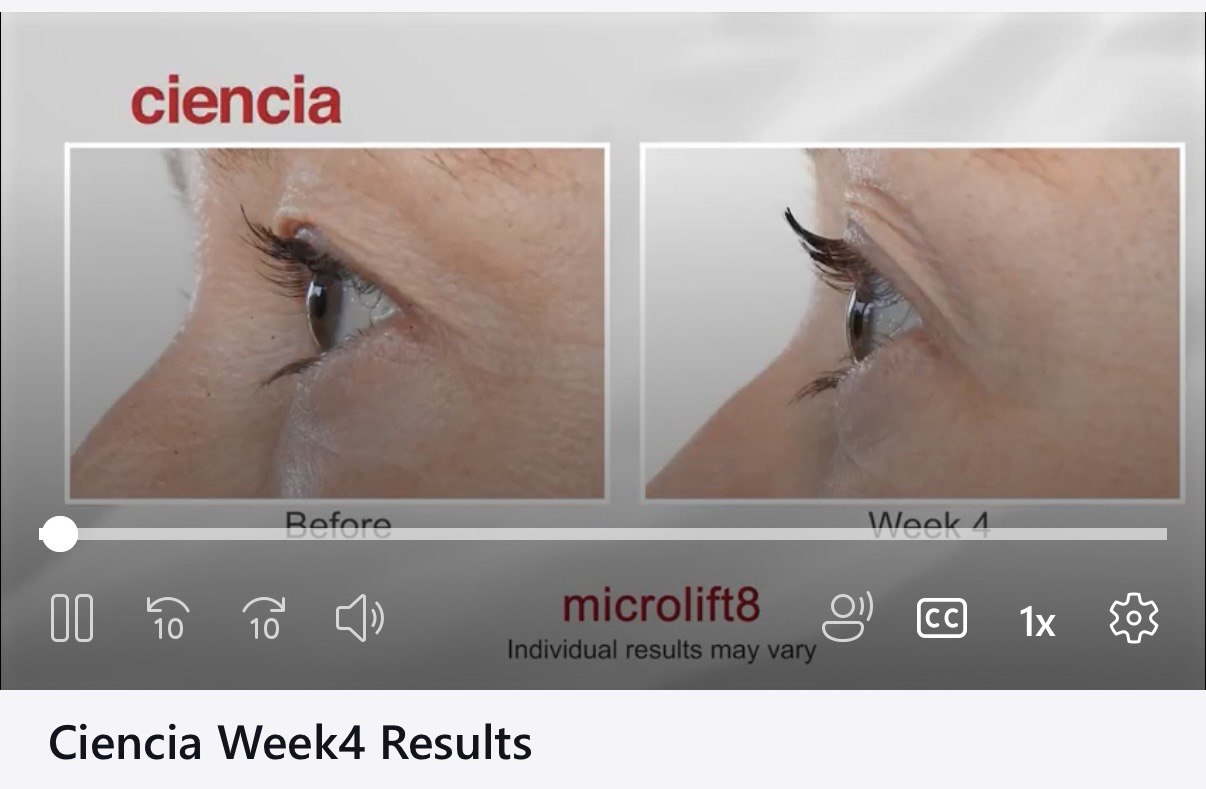 Microlift8 Before and After - Week 4 Results